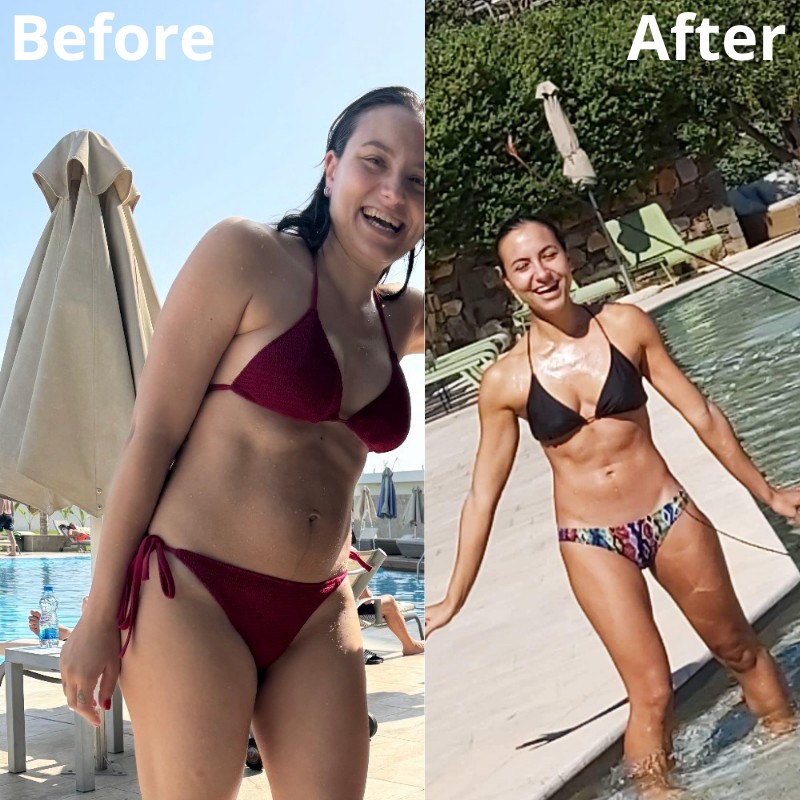 Before and After - Vasiliki G.